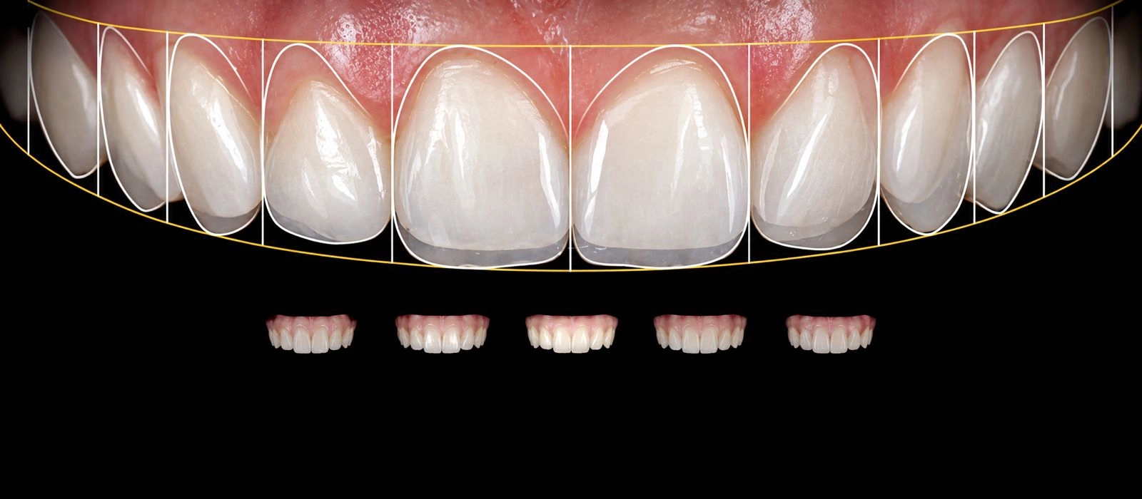 Image module